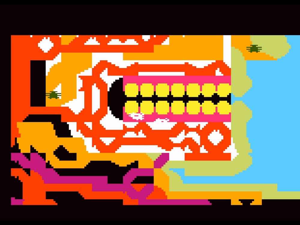 Gameplay of Microsurgeon for Intellivision